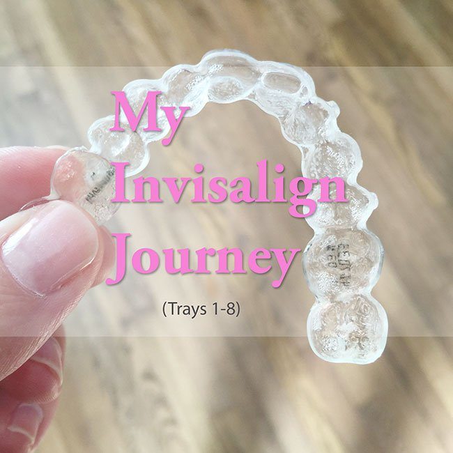 My Invisalign Journey (Trays 1-8) and Progression Photos